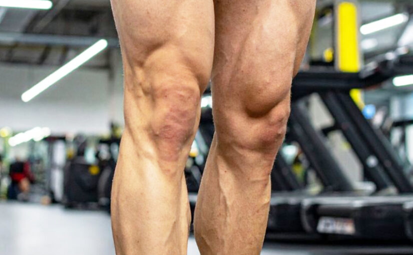 Why Are My Legs Strong but Not Big — and How to Fix It